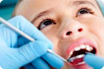 Invisalign First – chỉnh nha bằng máng trong suốt cho trẻ em