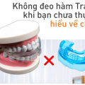 Niềng răng bằng hàm trainer có thật sự hiệu quả
