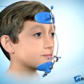 Facemask – giải pháp cho trẻ khớp cắn ngược