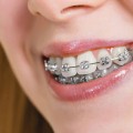 How to handle common problems in orthodontics