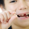 Frequently Asked Questions (FAQs) about baby tooth extraction